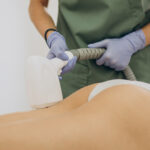 Buttocks cheeks - Laser Hair Removal