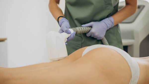 Buttocks cheeks - Laser Hair Removal